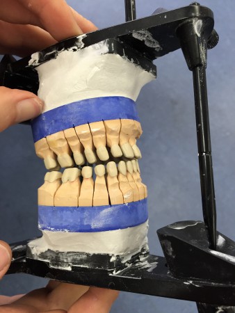 Tandtekniker til aftagelig protetik søges