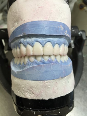 Tandtekniker til aftagelig protetik søges
